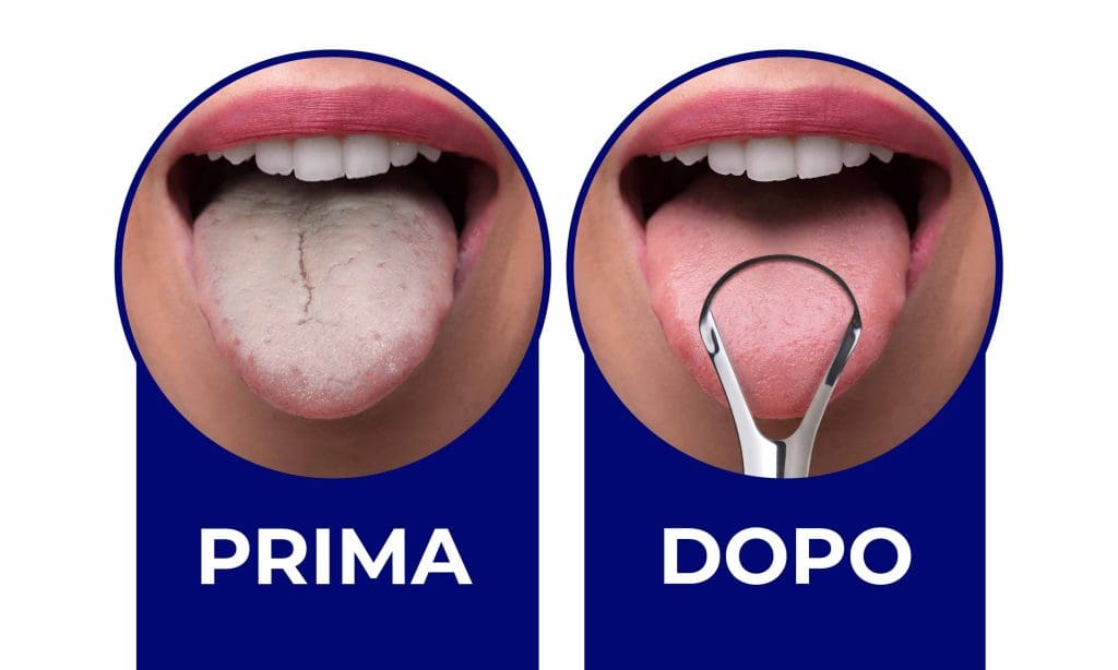 prima/dopo l'uso del raschietto per la lingua