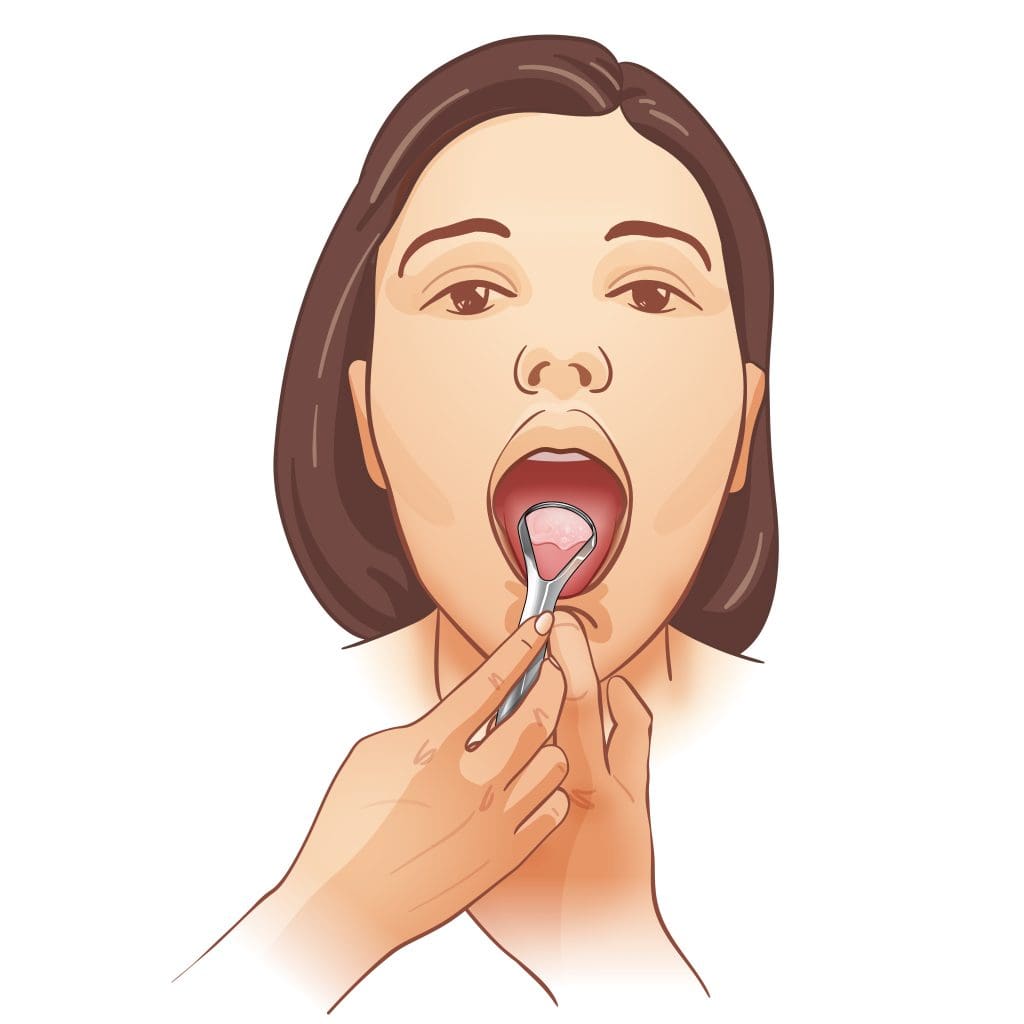 pressing the chin to avoid gag reflex