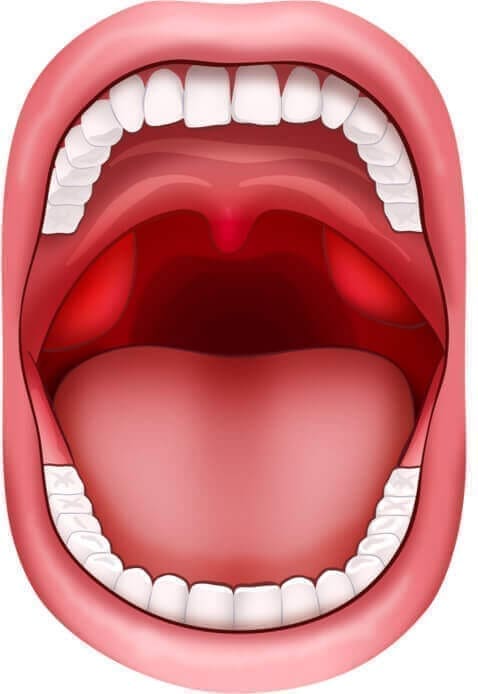 Amygdales rouges et gonflées