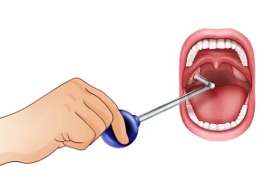 tonsil-stone-vacuum-release-suction