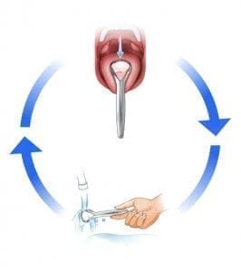 Tongue Scraper
