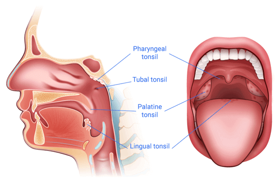 Anatomia dei calcoli tonsillari